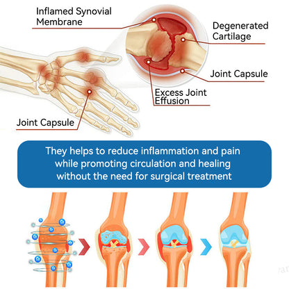 Juxek™ BPC-157 Joint Healing Cream 🦴Treats Arthritis, Neuropathy, Rheumatism, Sports Injuries & More👍