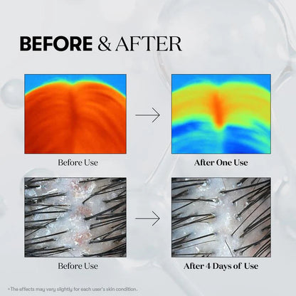 PDRN Reedle Shot Hair Ampoule Hair Growth Hair loss treatment ampoule serum