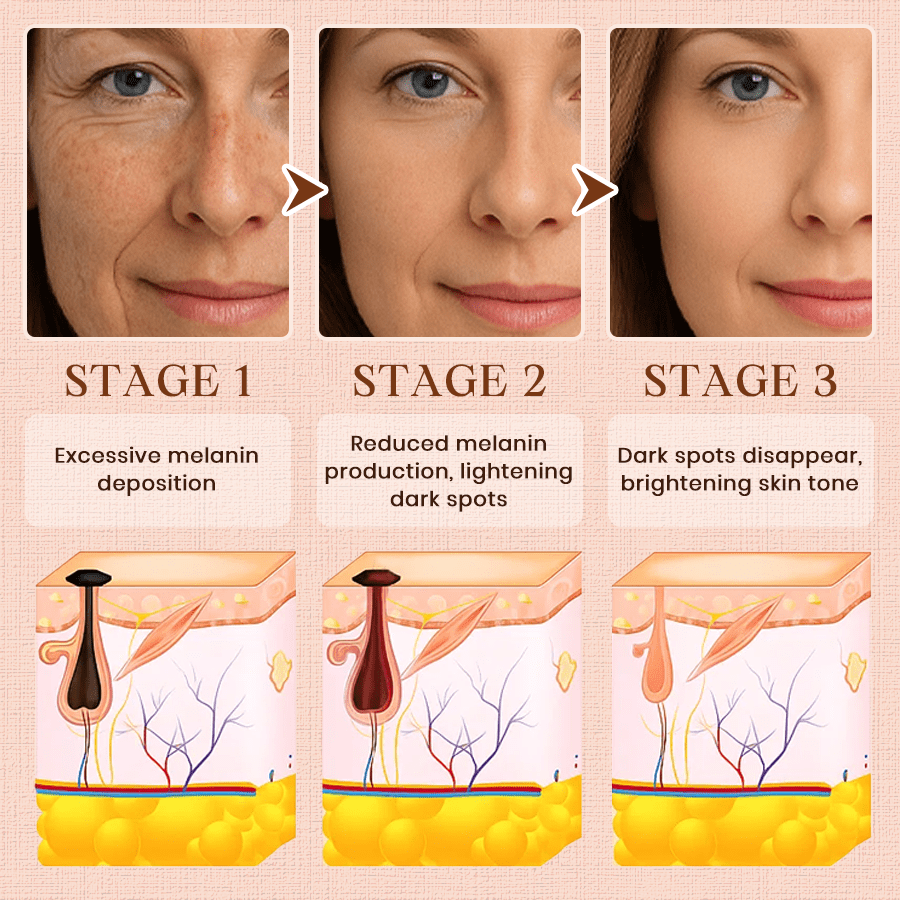 NEENCE® Purifying Exfoliating Gel for Acanthosis Nigricans, Exfoliation, Dark Spots, Skin Tags, and Eczema_Ultra01