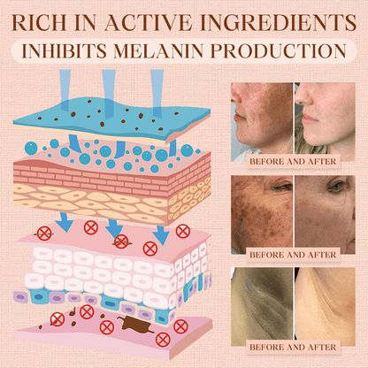 NEENCE® Purifying Exfoliating Gel for Acanthosis Nigricans, Exfoliation, Dark Spots, Skin Tags, and Eczema_Ultra01