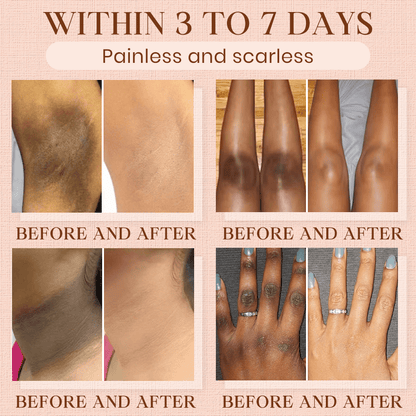 NEENCE® Purifying Exfoliating Gel for Acanthosis Nigricans, Exfoliation, Dark Spots, Skin Tags, and Eczema_Ultra01