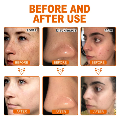 🌸[Official Brand Store] BBOJI™ Herbal Spots Peel-Off Facial Mask