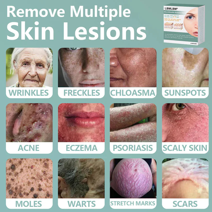 🔥Final 3 Hours: 80% OFF - LBMLBM® MicroNeedle Botanic Skin Tag Removal Patch 🇺🇸 Made in the USA
