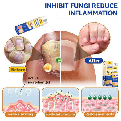 ODALIT™ PsoriaHeal Bee Venom Psoriasis Treatment Spray pro