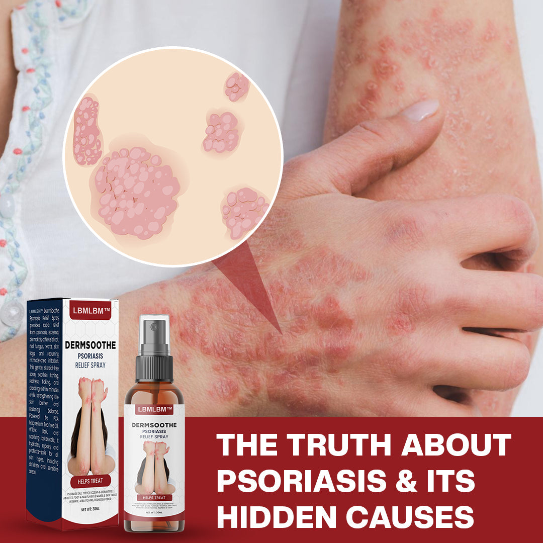 【Last Day Promotion 80% OFF🔥】LBMLBM™ DermSoothe Psoriasis Relief Spray🇺🇸👨‍⚕️（Zero Itch, 3-Min Relief | 99.5% Skin Recovery Rate | All-Natural, 24/7 Repair | ）🔥🎁