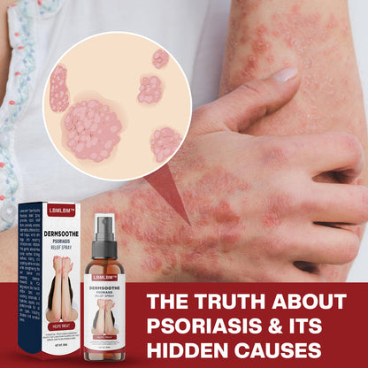 【Last Day Promotion 80% OFF🔥】LBMLBM™ DermSoothe Psoriasis Relief Spray🇺🇸👨‍⚕️（Zero Itch, 3-Min Relief | 99.5% Skin Recovery Rate | All-Natural, 24/7 Repair | ）🔥🎁