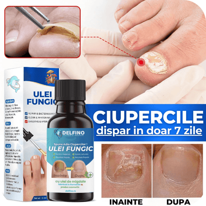 🔥Last 3 hours discount:Ulei fungic pentru ciuperca fungica