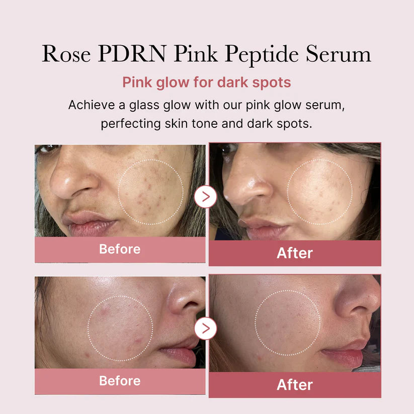 Final 3 hours 50% off:🌸Rose PDRN Pink Peptide Serum🔥