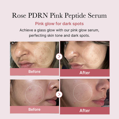 Final 3 hours 50% off:🌸Rose PDRN Pink Peptide Serum🔥