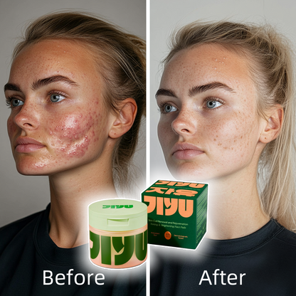 🌸Skincare Toner Pads – Anti-Aging, Dark Spot & Wrinkle Care with Snail Mucin & Peptides 🌸