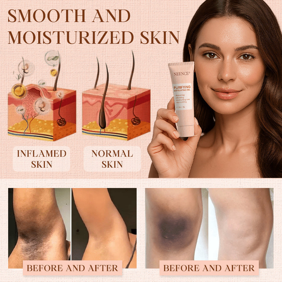 NEENCE® Purifying Exfoliating Gel for Acanthosis Nigricans, Exfoliation, Dark Spots, Skin Tags, and Eczema_Ultra01