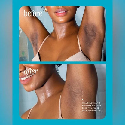 ⚡️5-Second Post-Hair Removal Rescue: Bumps Fade, Skin Glows! Glass Smooth Oil.